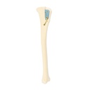 SPP Patella Luxation System