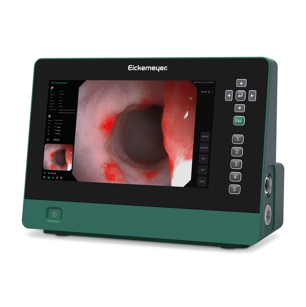 EickView 5-in-1 Monitor